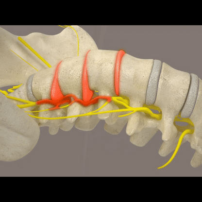 Aparat pentru detensionarea spatelui și coloanei
